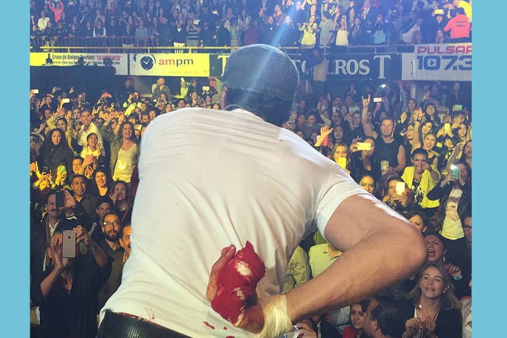 5 Times Musicians Played Through Epic On-Stage Injuries
